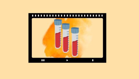 Análisis de sangre para predecir el alzhéimer: comienza una nueva era en la prevención